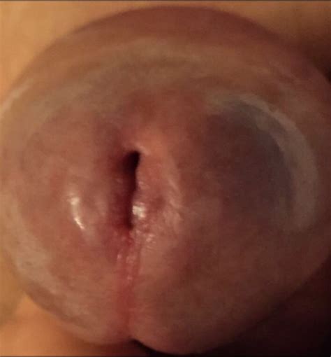Ccock blog » Close-up penis glans Ccock blog Closeup penis glans