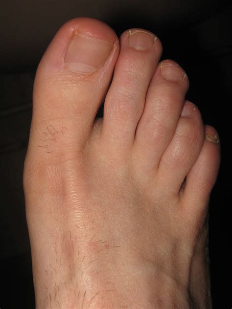 hairy legs and feet | hairy feet and toes close-up | Joey ...