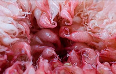 HoodPoetry : Microscopic photo of the inside of a vagina ...