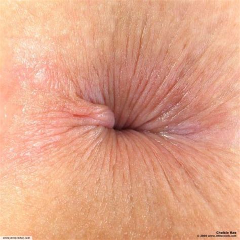 Ass Hole Close Up - Image 4 FAP