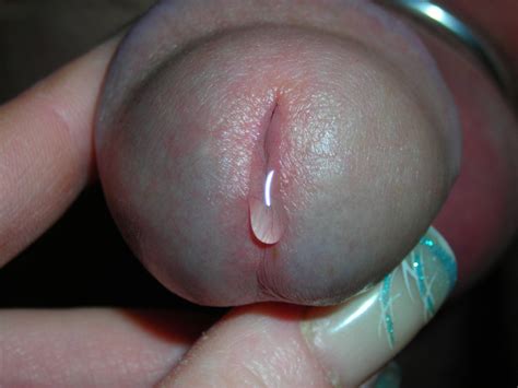 Uncut Penis Head Cum Close Up
