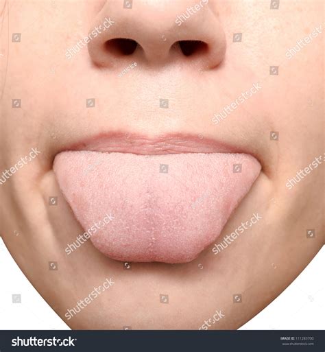 Close Up Of Healthy Tongue Stock Photo 111283700 ...