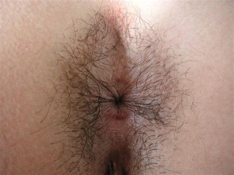 Asses Photo | Hairy stinky asshole closeups compilation Asses Photo Hairy stinky asshole closeups compilation