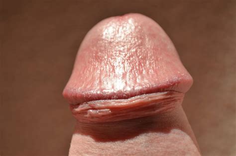Uncut Penis Head Close Up