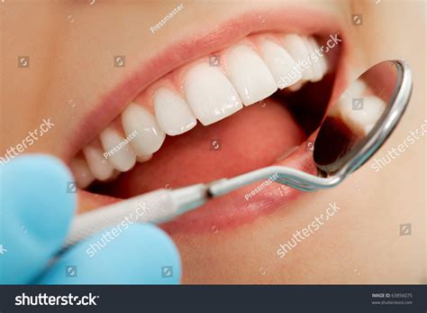 Closeup Open Mouth During Oral Checkup Stock Photo ...
