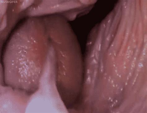 Anal Speculum Pics - Xxx Suck Cock