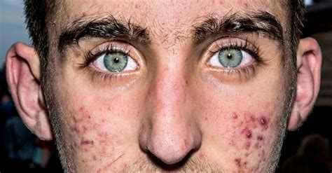 Painfully Close Photos Of Human Faces Look Strangely ...